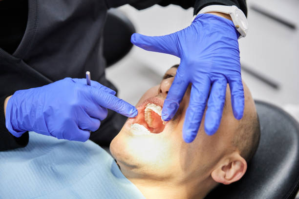 Best Emergency Wisdom Teeth Removal in Wellsville, UT